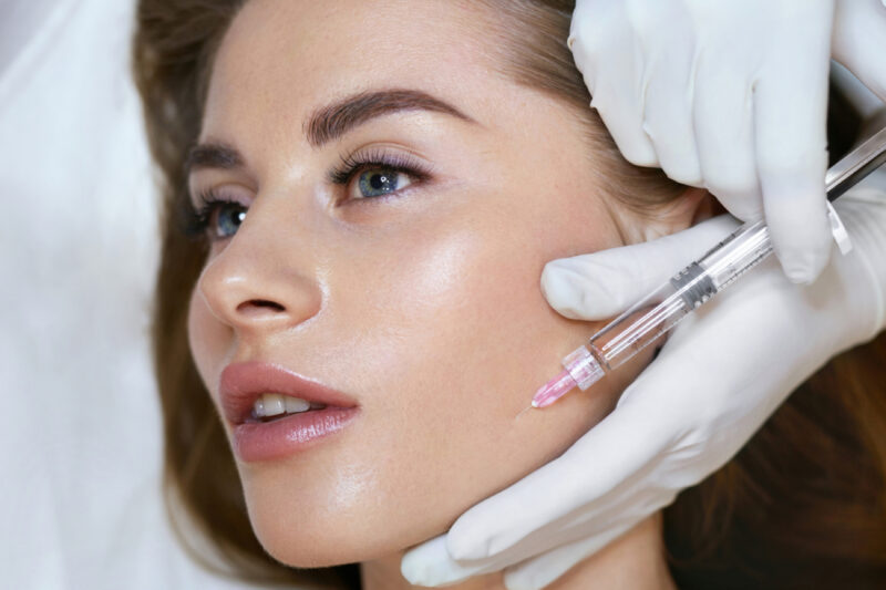 Trattamenti medicina estetica: filler zigomi