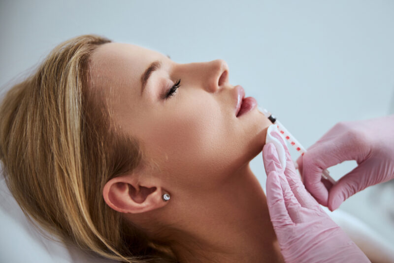 Trattamenti medicina estetica: filler labbra